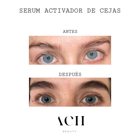 testimonio-serum-cejas-2