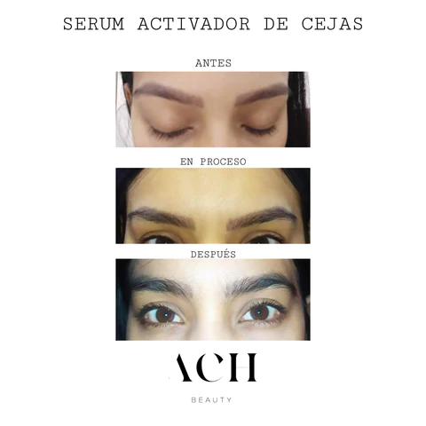 testimonio-serum-cejas-3