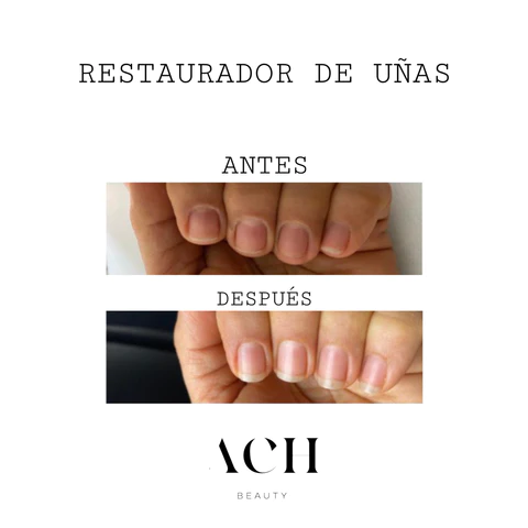 Testimonio uñas 1