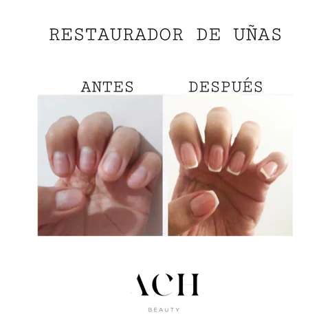 Testimonio uñas 2