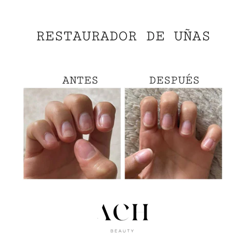 Testimonio uñas 3